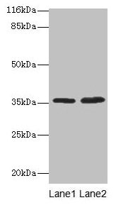 ACKR1 / DARC Antibody - Western blot All lanes: ACKR1 antibody at 2µg/ml Lane 1: Mouse kidney tissue Lane 2mouse spleen tissue Secondary Goat polyclonal to rabbit IgG at 1/10000 dilution Predicted band size: 36 kDa Observed band size: 36 kDa