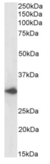 ACKR1 / DARC Antibody - Western blot using human liver lysates.