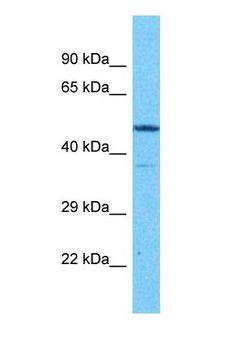 ACKR1 / DARC Antibody - Western blot of DARC Antibody with human NCI-H226 Whole Cell lysate.  This image was taken for the unconjugated form of this product. Other forms have not been tested.