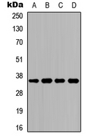 ACKR1 / DARC Antibody - Western blot analysis of CD234 expression in HeLa (A); K562 (B); Raw264.7 (C); PC12 (D) whole cell lysates.