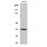 ACKR2 / CCR10 / D6 Antibody - Western blot of Chemokine Receptor D6 antibody