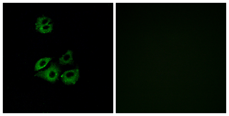 ACKR2 / CCR10 / D6 Antibody - Immunofluorescence analysis of A549 cells, using CCBP2 Antibody. The picture on the right is blocked with the synthesized peptide.