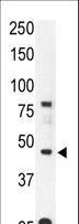 ACKR2 / CCR10 / D6 Antibody - The anti-CCBP2 N-term antibody is used in Western blot to detect CCBP2 in mouse liver tissue lysate.