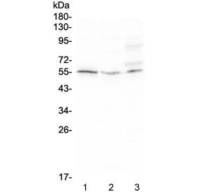 ACKR2 / CCR10 / D6 Antibody - Western blot testing of human 1) Raji, 2) HeLa, and 3) SW620 cell lysate with D6 antibody at 0.5ug/ml. Predicted molecular weight ~43 kDa, can be observed at 50-55 kDa.