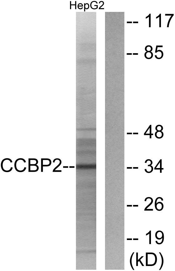 ACKR2 / CCR10 / D6 Antibody - Western blot analysis of extracts from HepG2 cells, using CCBP2 antibody.
