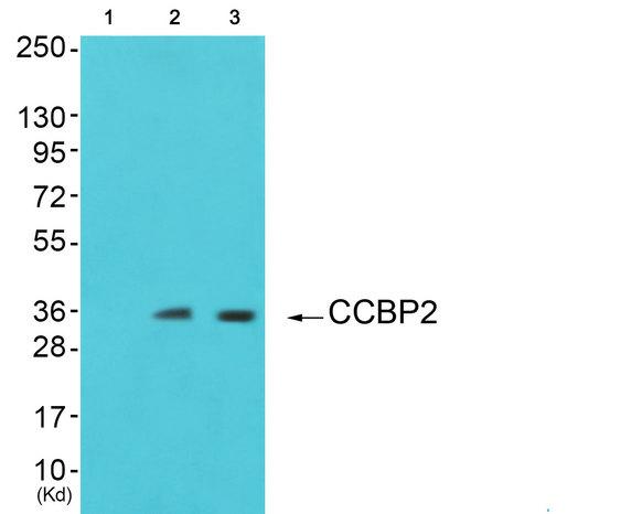 ACKR2 / CCR10 / D6 Antibody - Western blot analysis of extracts from JurKat cells and 293 cells, using CCBP2 antibody.