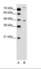 ACKR2 / CCR10 / D6 Antibody - A: Marker, B: Jurkat Cell Lysate.  This image was taken for the unconjugated form of this product. Other forms have not been tested.