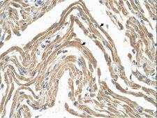 ACKR2 / CCR10 / D6 Antibody - CCBP2 / D6 antibody ARP30776_P050-NP_001287-CCBP2(chemokine binding protein 2) Antibody was used in IHC to stain formalin-fixed, paraffin-embedded human muscle.  This image was taken for the unconjugated form of this product. Other forms have not been tested.