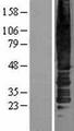 ACKR2 / CCR10 / D6 Protein - Western validation with an anti-DDK antibody * L: Control HEK293 lysate R: Over-expression lysate