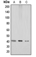 ACKR3 / CXCR7 Antibody - Western blot analysis of GPR159 expression in HEK293T (A); mouse kidney (B); rat kidney (C) whole cell lysates.