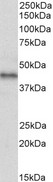 ACKR3 / CXCR7 Antibody - Goat Anti-CXCR7 / RDC1 Antibody (2µg/ml) staining of Human Breast cancer lysate (35µg protein in RIPA buffer). Primary incubation was 1 hour. Detected by chemiluminescencence.