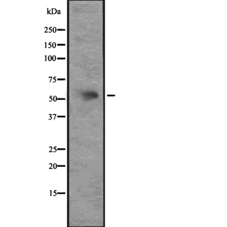 ACKR3 / CXCR7 Antibody - Western blot analysis of CXCR7 expression in HEK293 cells. The lane on the left is treated with the antigen-specific peptide.