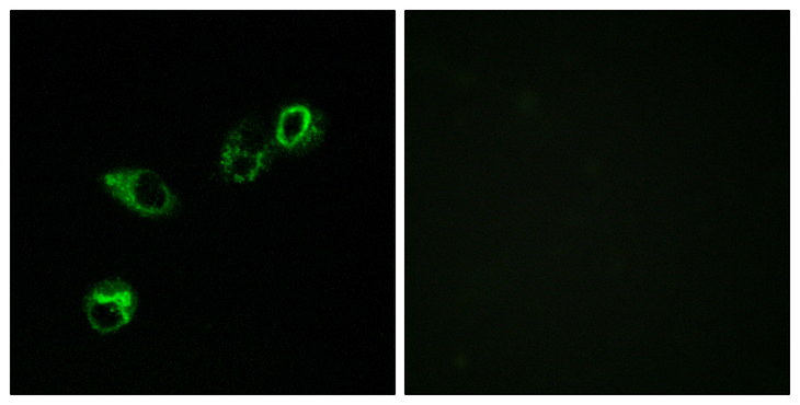 ACKR4 / CCRL1 / CCR11 Antibody - Immunofluorescence analysis of MCF7 cells, using CCRL1 Antibody. The picture on the right is blocked with the synthesized peptide.