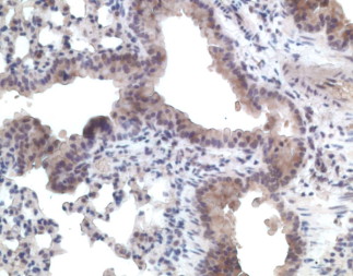 ACKR4 / CCRL1 / CCR11 Antibody - IHC of CCRL1 / CCR11 antibody. Formalin-fixed, paraffin-embedded mouse lung.