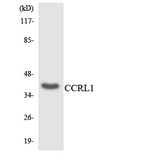 ACKR4 / CCRL1 / CCR11 Antibody - Western blot analysis of the lysates from HepG2 cells using CCRL1 antibody.