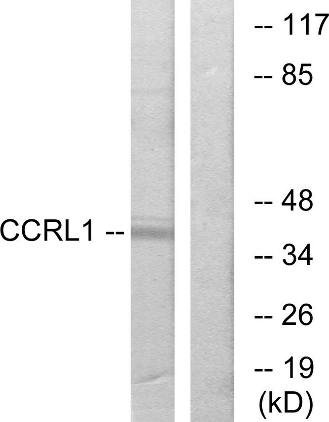 ACKR4 / CCRL1 / CCR11 Antibody - Western blot analysis of lysates from 293 cells, using CCRL1 Antibody. The lane on the right is blocked with the synthesized peptide.