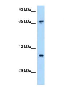 ACKR4 / CCRL1 / CCR11 Antibody - CCRL1 antibody Western blot of 721_B Cell lysate. Antibody concentration 1 ug/ml.  This image was taken for the unconjugated form of this product. Other forms have not been tested.