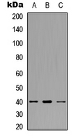 ACKR4 / CCRL1 / CCR11 Antibody - Western blot analysis of CCR11 expression in HeLa (A); SW480 (B); HepG2 (C) whole cell lysates.