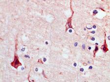 ACKR4 / CCRL1 / CCR11 Antibody - Clone 1G4 human brain cortex, paraffin section