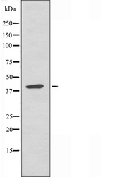ACKR4 / CCRL1 / CCR11 Antibody - Western blot analysis of extracts of HepG2 cells using CCRL1 antibody.