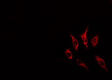 ACKR4 / CCRL1 / CCR11 Antibody - Staining HepG2 cells by IF/ICC. The samples were fixed with PFA and permeabilized in 0.1% Triton X-100, then blocked in 10% serum for 45 min at 25°C. The primary antibody was diluted at 1:200 and incubated with the sample for 1 hour at 37°C. An Alexa Fluor 594 conjugated goat anti-rabbit IgG (H+L) antibody, diluted at 1/600, was used as secondary antibody.