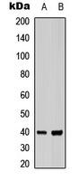 ACKR4 / CCRL1 / CCR11 Antibody - Western blot analysis of CCR11 expression in HEK293T (A); NIH3T3 (B) whole cell lysates.