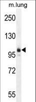 ACLP / AEBP1 Antibody - AEBP1 Antibody western blot of mouse lung tissue lysates (35 ug/lane). The AEBP1 antibody detected the AEBP1 protein (arrow).