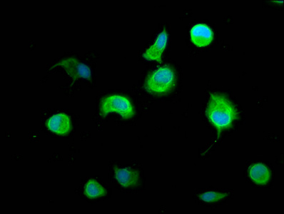 ACLP / AEBP1 Antibody - Immunofluorescence staining of MCF-7 cells diluted at 1:100, counter-stained with DAPI. The cells were fixed in 4% formaldehyde, permeabilized using 0.2% Triton X-100 and blocked in 10% normal Goat Serum. The cells were then incubated with the antibody overnight at 4°C.The Secondary antibody was Alexa Fluor 488-congugated AffiniPure Goat Anti-Rabbit IgG (H+L).