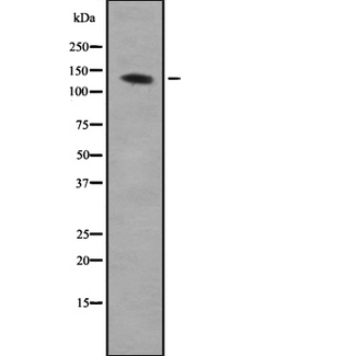 ACLP / AEBP1 Antibody - Western blot analysis of AEBP1 expression in HEK293 cells. The lane on the left is treated with the antigen-specific peptide.