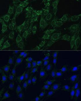 ACLP / AEBP1 Antibody - Immunofluorescence analysis of C6 cells using AEBP1 Polyclonal Antibody at dilution of 1:100 (40x lens).Blue: DAPI for nuclear staining.