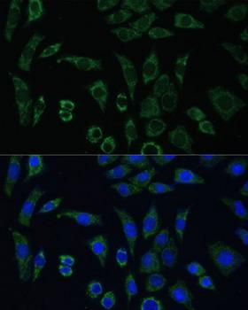 ACLP / AEBP1 Antibody - Immunofluorescence analysis of L929 cells using AEBP1 Polyclonal Antibody at dilution of 1:100 (40x lens).Blue: DAPI for nuclear staining.