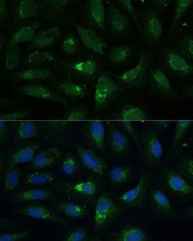 ACLP / AEBP1 Antibody - Immunofluorescence analysis of U-2OS cells using AEBP1 Polyclonal Antibody at dilution of 1:100 (40x lens).Blue: DAPI for nuclear staining.