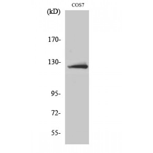 ACLY / ATP Citrate Lyase Antibody - Western blot of ATP-citrate synthase antibody