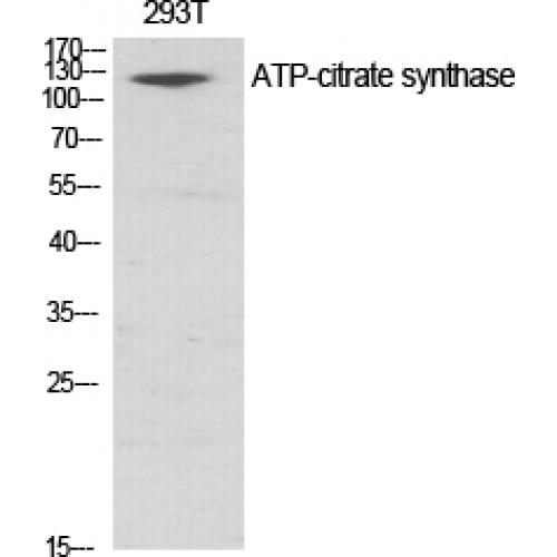 ACLY / ATP Citrate Lyase Antibody - Western blot of ATP-citrate synthase antibody