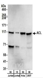 ACLY / ATP Citrate Lyase Antibody - Detection of Human ACL by Western Blot. Samples: Whole cell lysate from Jurkat (15 and 50 ug), HeLa (50 ug), and 293T (50 ug) cells. Antibodies: Affinity purified rabbit anti-ACL antibody used for WB at 0.4 ug/ml. Detection: Chemiluminescence with an exposure time of 30 seconds.