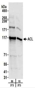 ACLY / ATP Citrate Lyase Antibody - Detection of Mouse ACL by Western Blot. Samples: Whole cell lysate (15 and 50 ug) from mouse NIH3T3 cells. Antibodies: Affinity purified rabbit anti-ACL antibody used for WB at 0.4 ug/ml. Detection: Chemiluminescence with an exposure time of 10 seconds.