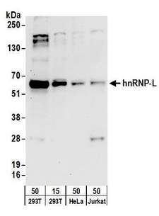 ACLY / ATP Citrate Lyase Antibody - Detection of human hnRNP-L by western blot. Samples: Whole cell lysate from HEK293T (15 and 50 µg), HeLa (50µg), and Jurkat (50µg) cells. Antibodies: Affinity purified rabbit anti-hnRNP-L antibody used for WB at 0.1 µg/ml. Detection: Chemiluminescence with an exposure time of 30 seconds.