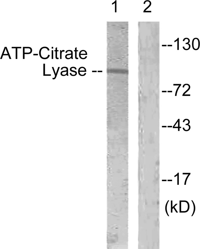 ACLY / ATP Citrate Lyase Antibody - Western blot analysis of lysates from COS7 cells, treated with Calyculin 50nM 30', using ATP-Citrate Lyase Antibody. The lane on the right is blocked with the synthesized peptide.