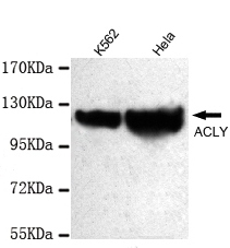 ACLY / ATP Citrate Lyase Antibody - ACLY (C-terminus) antibody at 1/1000 dilution Lane1: K562 whole cell lysate 40 ug/lane Lane2: HeLa whole cell lysate 40 ug/lane.