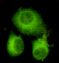 ACLY / ATP Citrate Lyase Antibody - Immunocytochemistry of HeLa cells using anti- ATP-Citrate Lyase (C-terminus) antibody diluted 1:150.