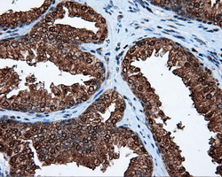 ACLY / ATP Citrate Lyase Antibody - IHC of paraffin-embedded prostate tissue using anti-ACLY mouse monoclonal antibody. (Dilution 1:50).