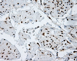 ACLY / ATP Citrate Lyase Antibody - IHC of paraffin-embedded bladder tissue using anti-ACLY mouse monoclonal antibody. (Dilution 1:50).