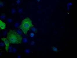 ACLY / ATP Citrate Lyase Antibody - Anti-ACLY mouse monoclonal antibody  immunofluorescent staining of COS7 cells transiently transfected by pCMV6-ENTRY ACLY.