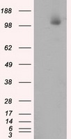 ACLY / ATP Citrate Lyase Antibody - HEK293T cells were transfected with the pCMV6-ENTRY control (Left lane) or pCMV6-ENTRY ACLY (Right lane) cDNA for 48 hrs and lysed. Equivalent amounts of cell lysates (5 ug per lane) were separated by SDS-PAGE and immunoblotted with anti-ACLY.