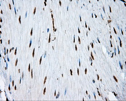ACLY / ATP Citrate Lyase Antibody - IHC of paraffin-embedded colon tissue using anti-ACLY mouse monoclonal antibody. (Dilution 1:50).