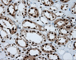 ACLY / ATP Citrate Lyase Antibody - IHC of paraffin-embedded Kidney tissue using anti-ACLY mouse monoclonal antibody. (Dilution 1:50).