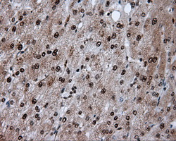 ACLY / ATP Citrate Lyase Antibody - IHC of paraffin-embedded liver tissue using anti-ACLY mouse monoclonal antibody. (Dilution 1:50).