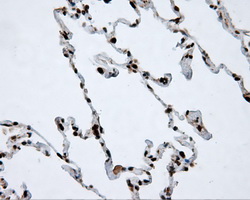 ACLY / ATP Citrate Lyase Antibody - IHC of paraffin-embedded lung tissue using anti-ACLY mouse monoclonal antibody. (Dilution 1:50).