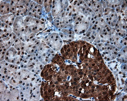 ACLY / ATP Citrate Lyase Antibody - IHC of paraffin-embedded pancreas tissue using anti-ACLY mouse monoclonal antibody. (Dilution 1:50).