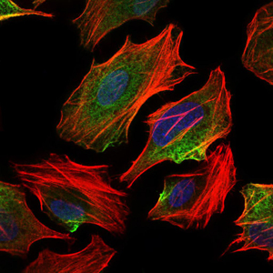ACLY / ATP Citrate Lyase Antibody - Immunofluorescence of HeLa cells using ACLY mouse monoclonal antibody (green). Blue: DRAQ5 fluorescent DNA dye. Red: Actin filaments have been labeled with Alexa Fluor-555 phalloidin.